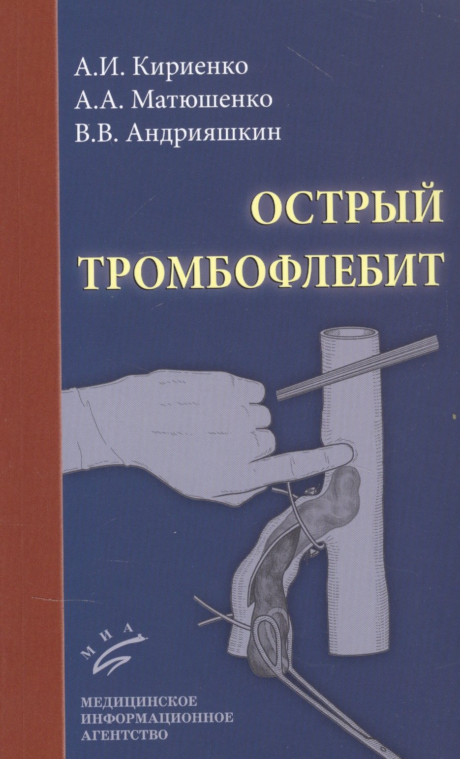 

Острый тромбофлебит