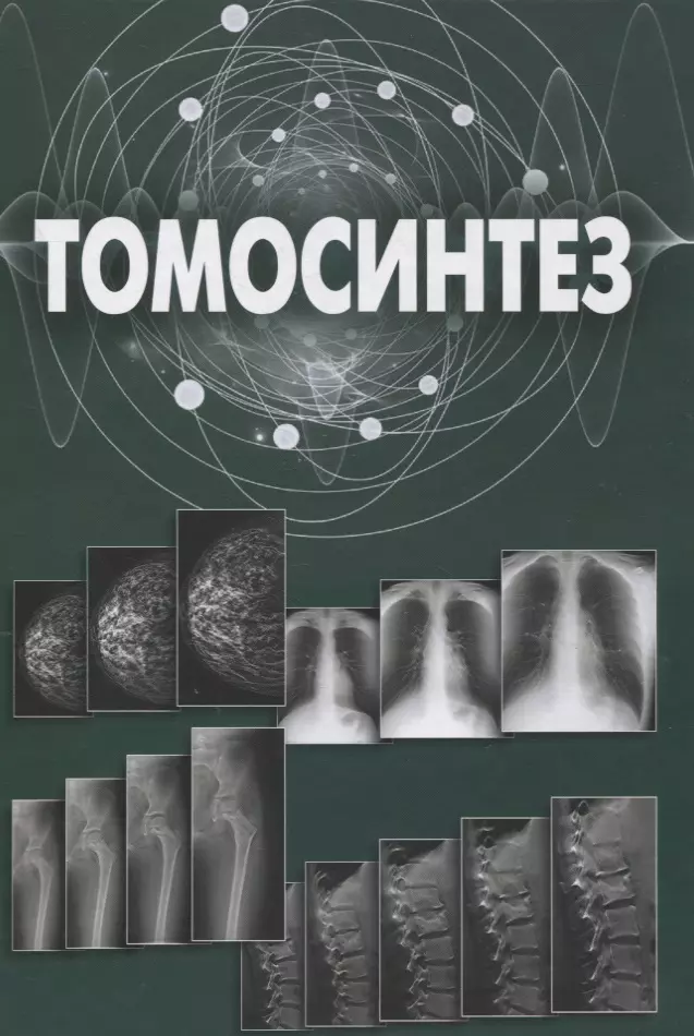 Томосинтез. Томосинтез в клинической практике. Рекомендован томосинтез. Математика для томосинтеза.