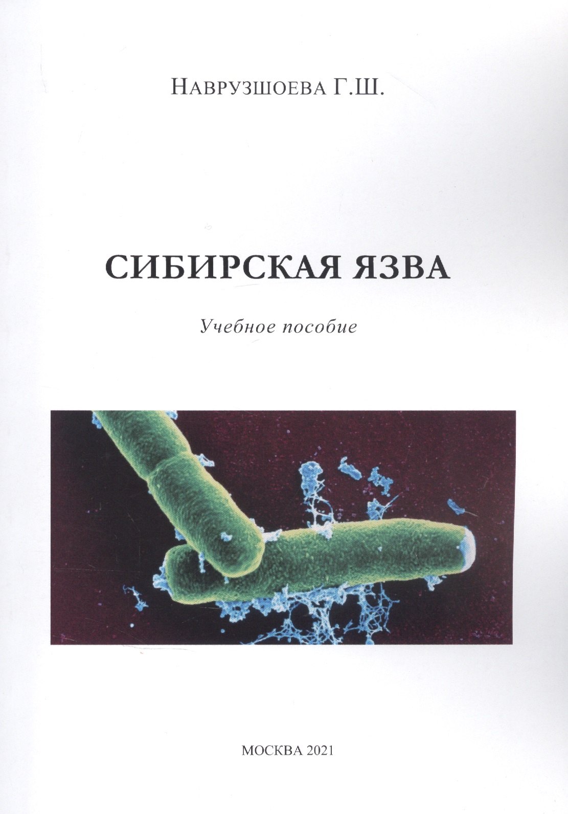 

Сибирская язва