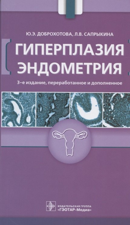 

Гиперплазия эндометрия