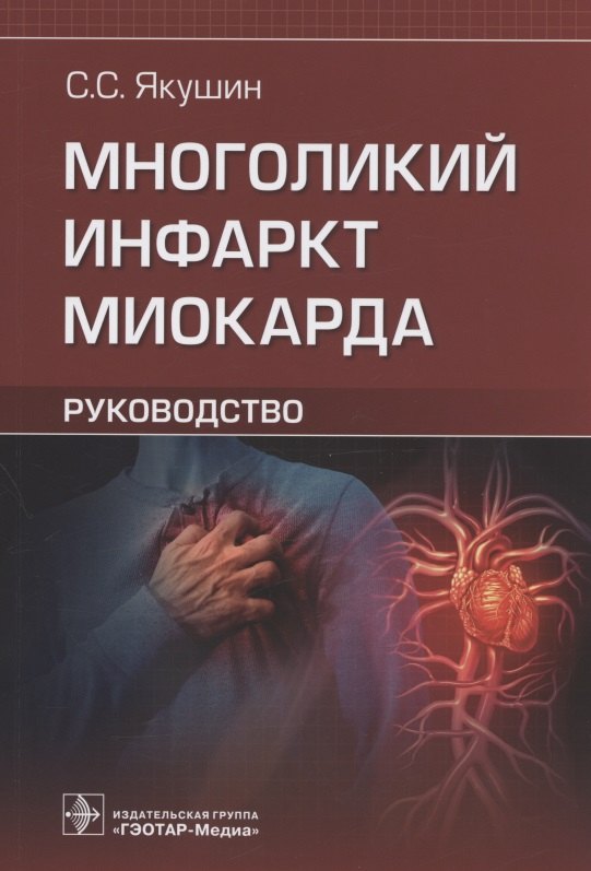 

Многоликий инфаркт миокарда: руководство