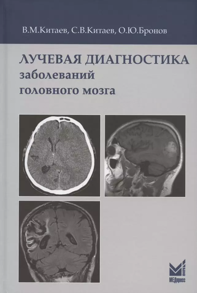 Китаев Вячеслав Михайлович - Лучевая диагностика заболеваний головного мозга. 3-е издание