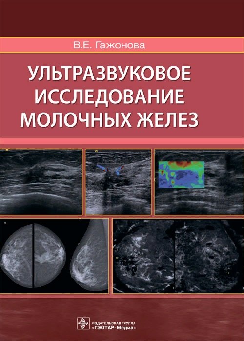 Гажонова Вероника Евгеньевна - Ультразвуковое исследование молочных желез