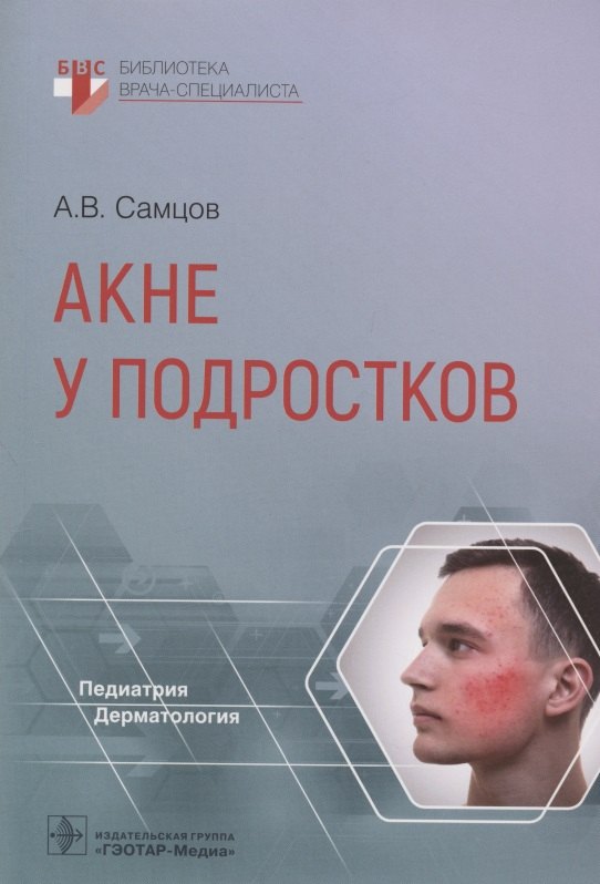 

Акне у подростков