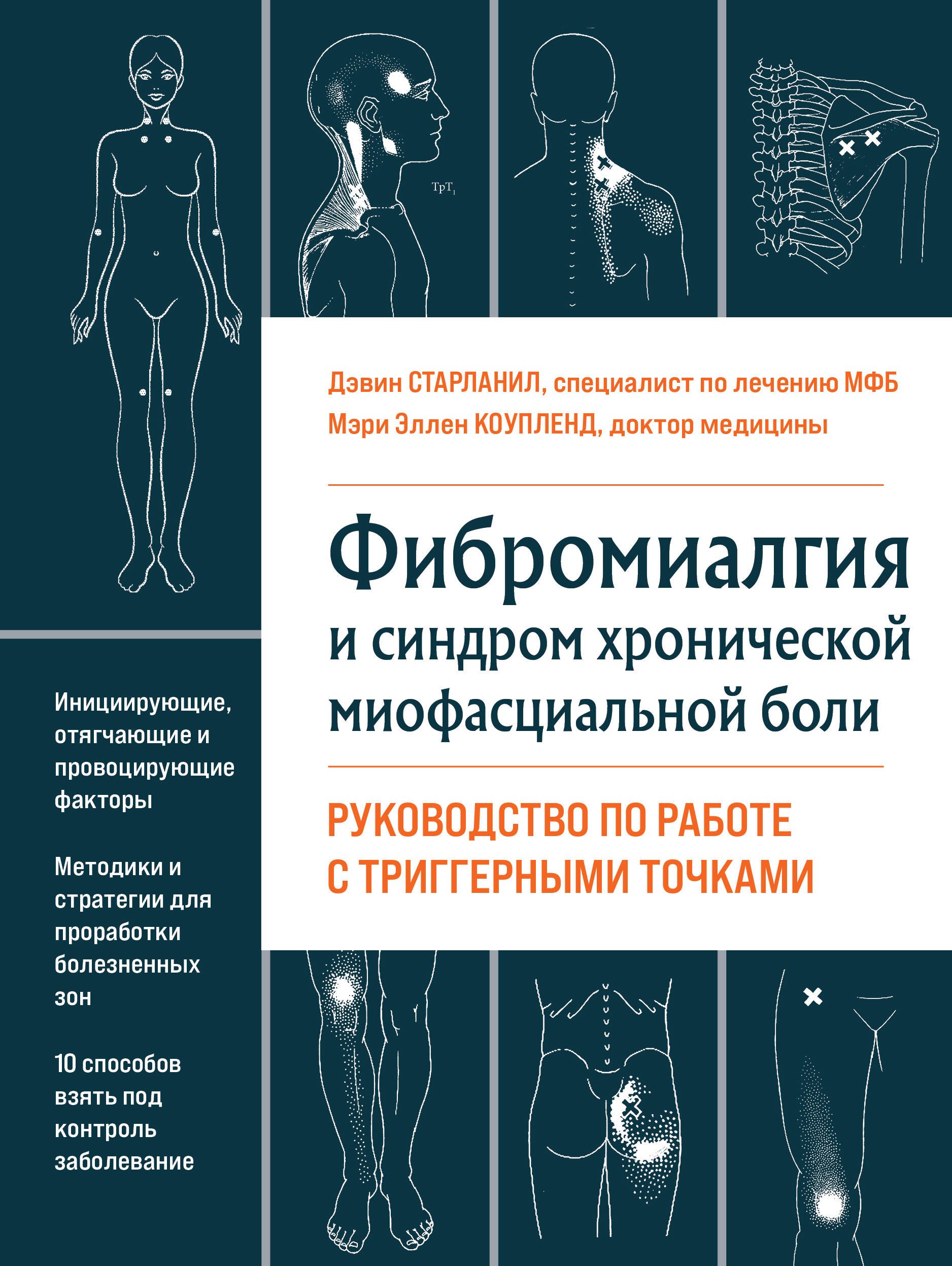 Коупленд Мэри Эллен, Старланил Дэвин - Фибромиалгия и синдром хронической миофасциальной боли. Руководство по работе с триггерными точками