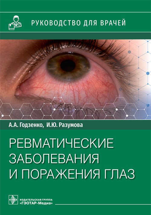 

Ревматические заболевания и поражения глаз: руководство для врачей