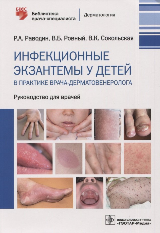 

Инфекционные экзантемы у детей в практике врача-дерматовенеролога : руководство для врачей