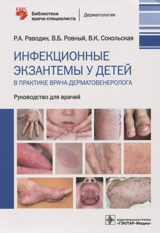 Раводин Роман Анатольевич, Ровный Виктор Борисович, Сокольская Валентина Константиновна - Инфекционные экзантемы у детей в практике врача-дерматовенеролога : руководство для врачей