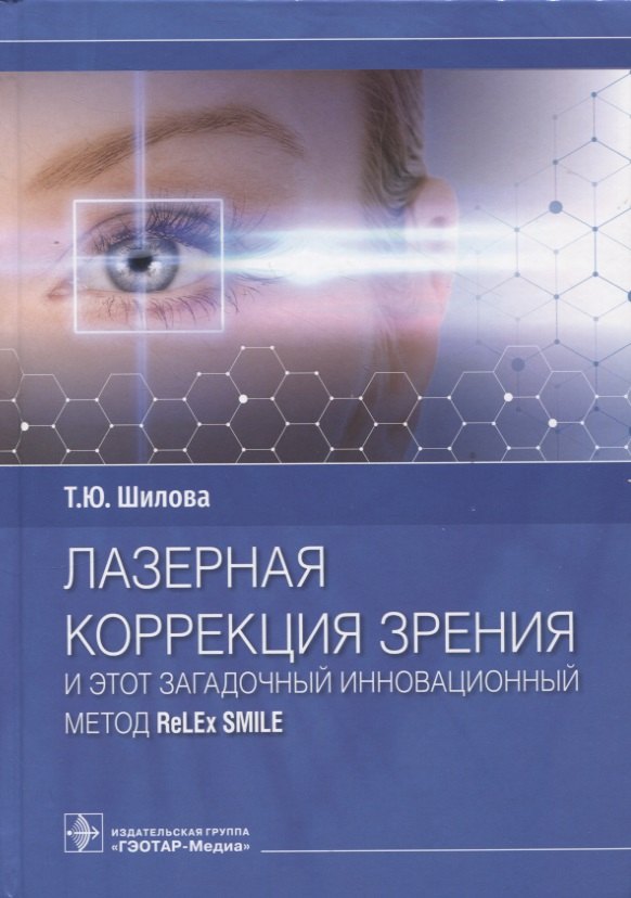 

Лазерная коррекция зрения и этот загадочный инновационный метод ReLEx SMILE