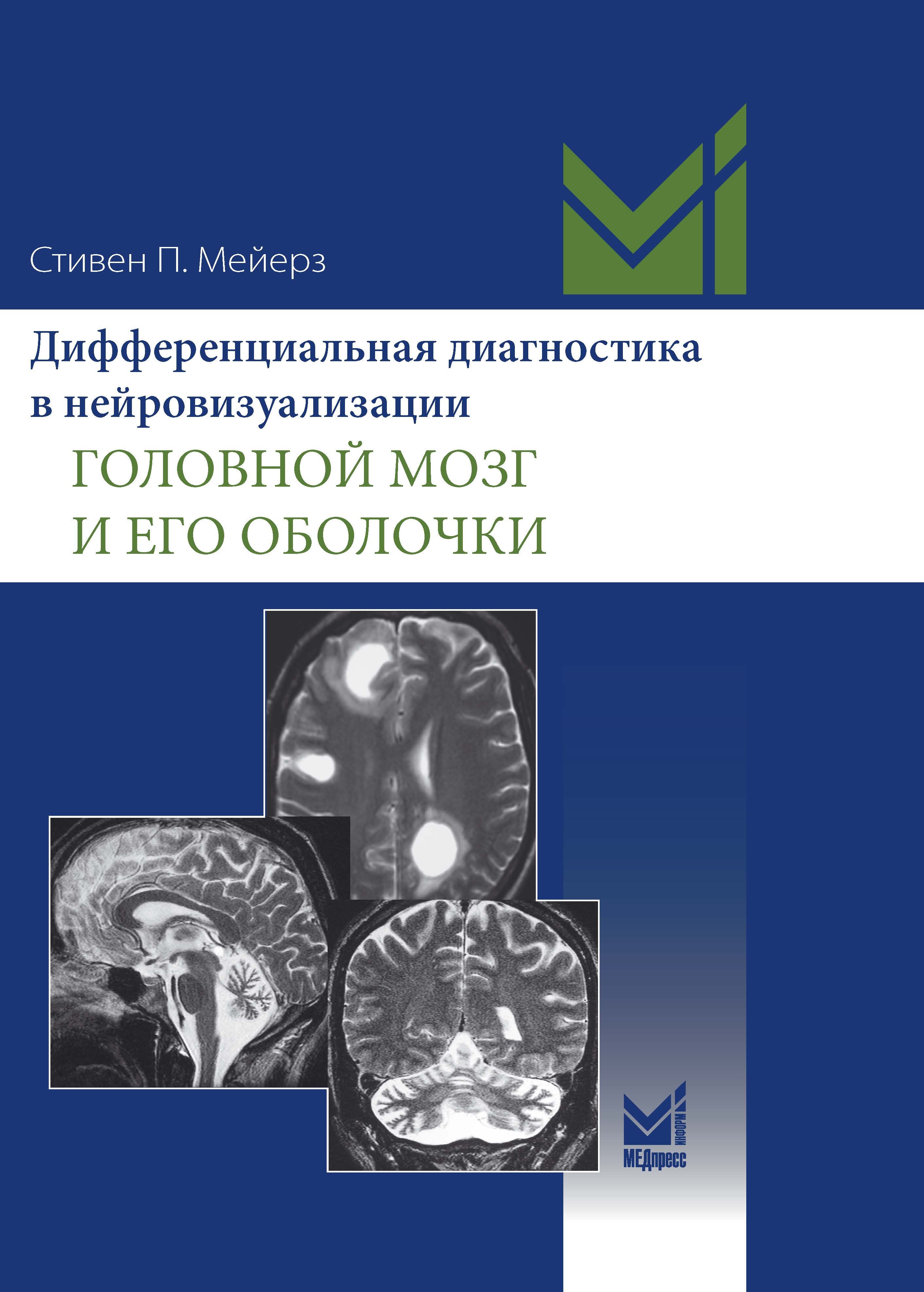 

Дифференциальная диагностика в нейровизуализации. Головной мозг и его оболочки