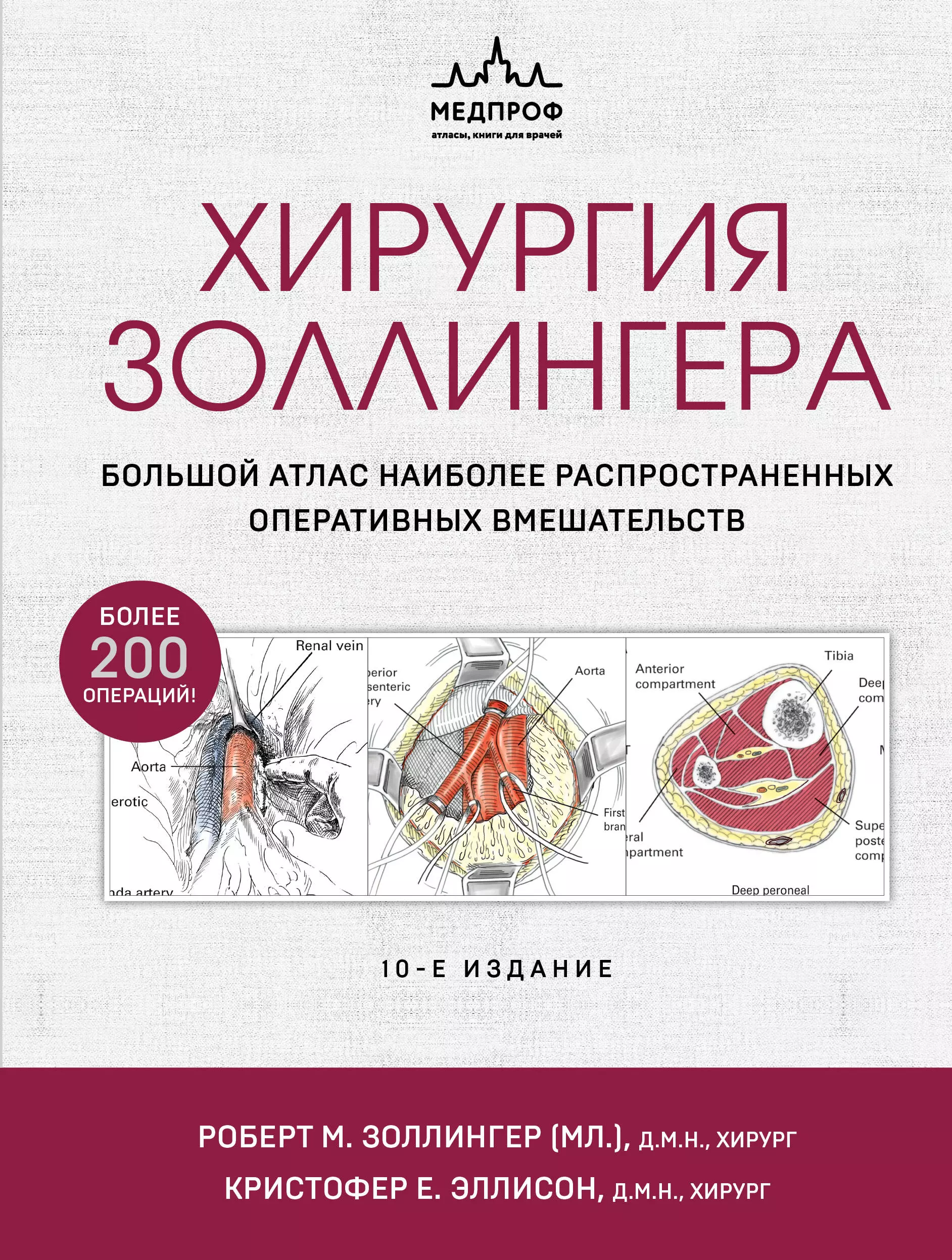 Хирургия Золлингера. Большой атлас наиболее распространенных оперативных вмешательств