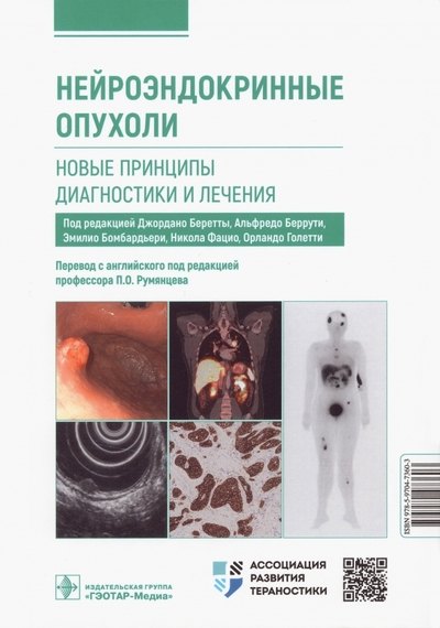 

Нейроэндокринные опухоли. Новые принципы диагностики и лечения. Руководство для врачей