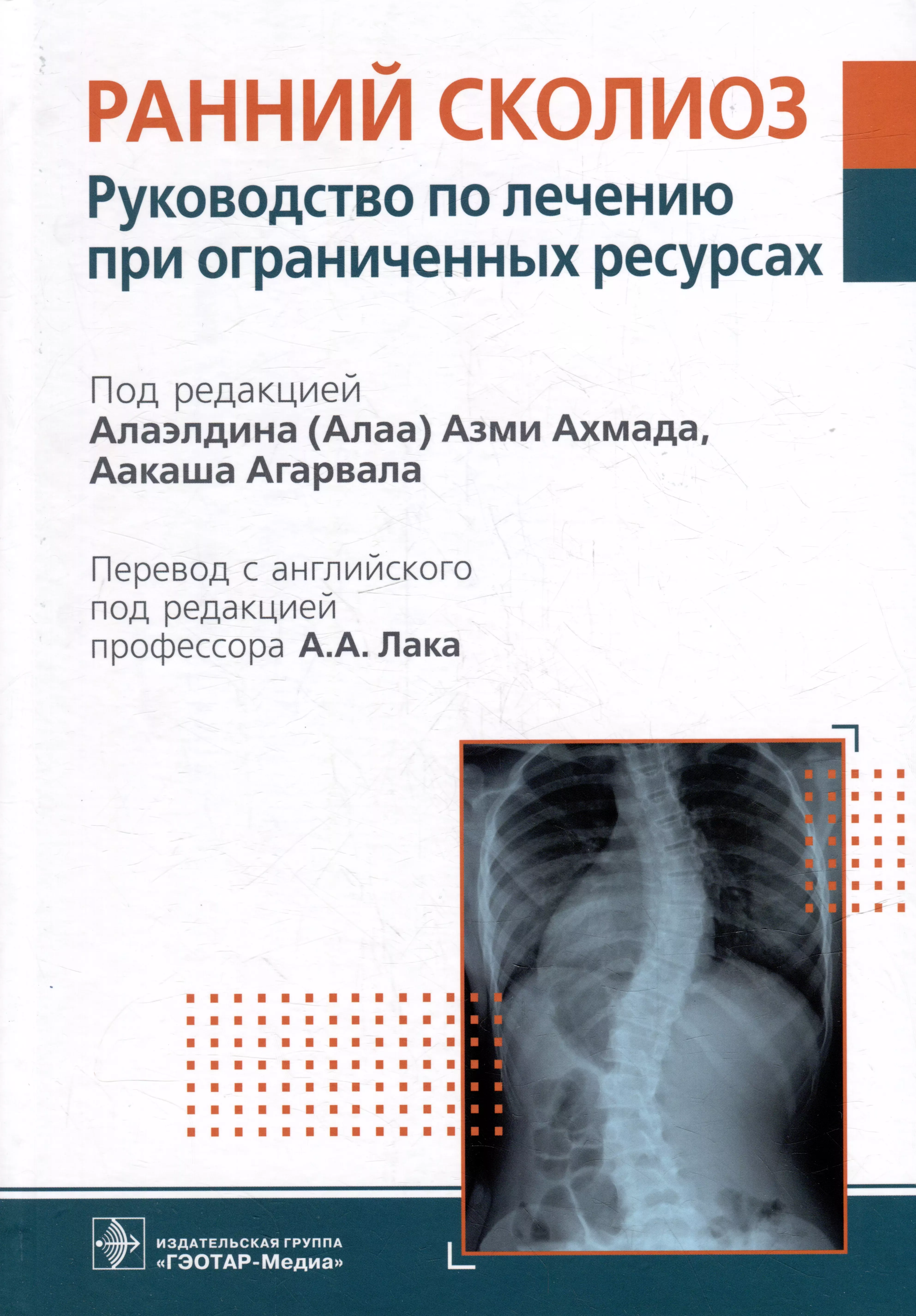  - Ранний сколиоз. Руководство по лечению при ограниченных ресурсах