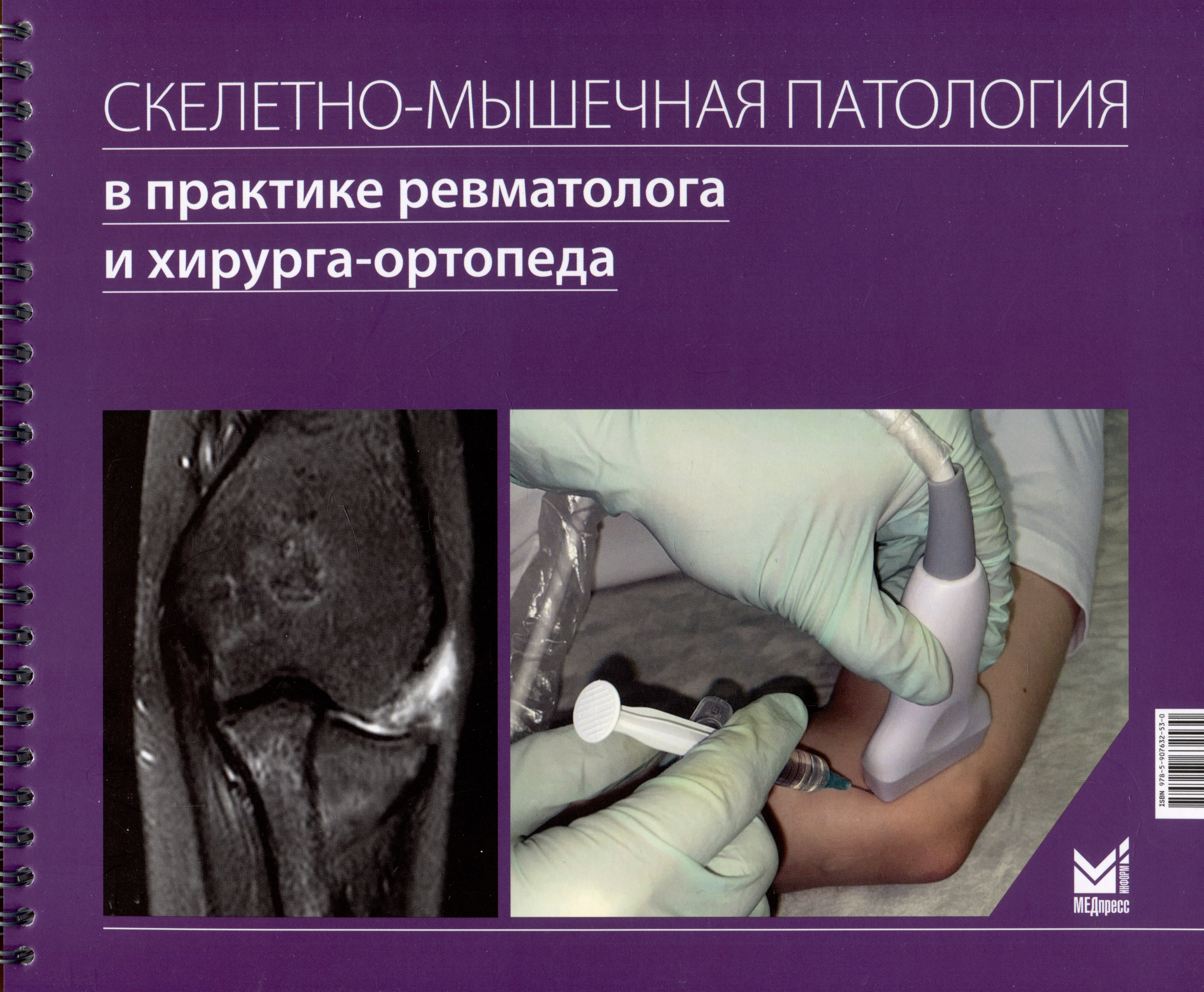 Скелетно-мышечная патология в практике ревматолога и хирурга-ортопеда:Краткое иллюстрированное руководство