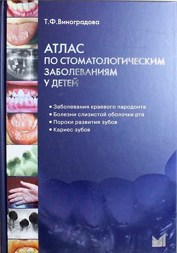 

Атлас по стоматологическим заболеваниям у детей: учебн. пособие + CD